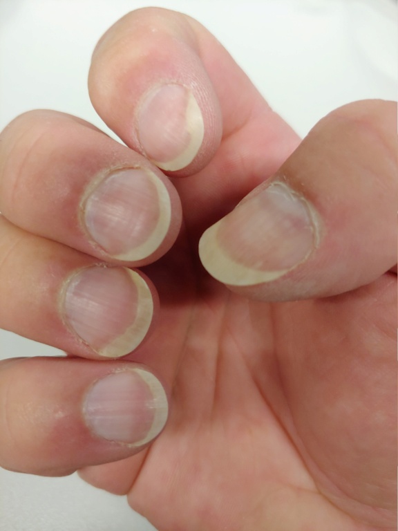 Young Girl Long Nails Plays Acoustic Stock Photo 2132111273 | Shutterstock